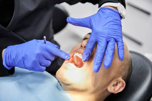 Best Emergency Treatment for Dental Infections or Abscesses in Hillcrest, NY